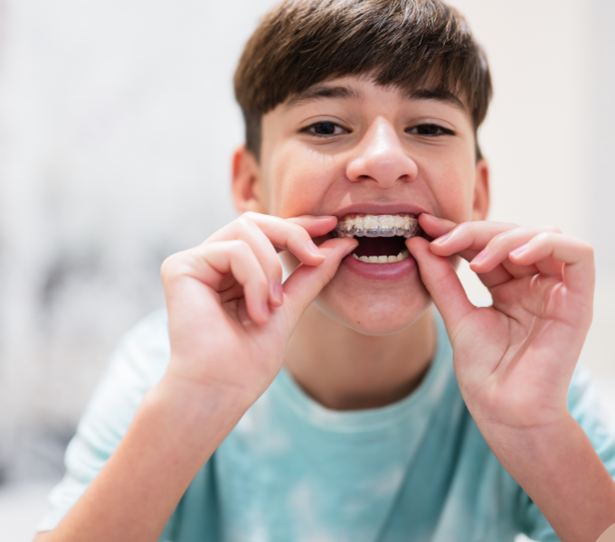 Orthodontics for Kids (3)